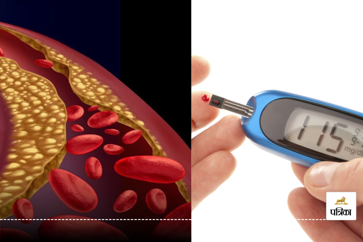 उच्च कोलेस्ट्रॉल और डायबिटीज का संबंध, जानें कोलेस्ट्रॉल कम करने के घरेलू उपाय